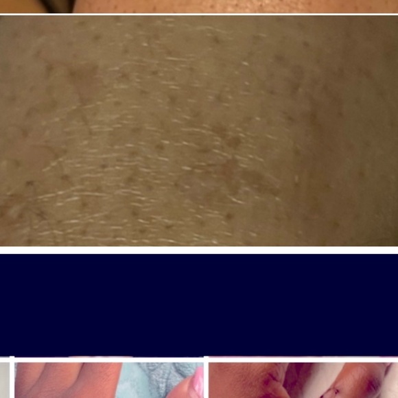 Moisturizes skin reduces dark spots improves skin elasticity - Picture 3 of 9